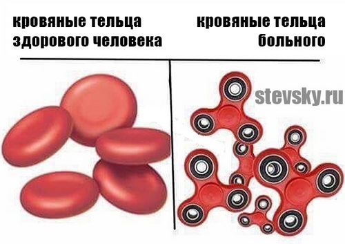 spinnermemerus5.jpg